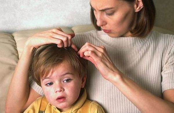 Частый зуд в области головы у ребенка - повод проверить его на наличие вшей и гнид