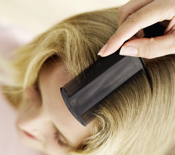 После нанесение 9% уксуса на волосы вшей будет легче вычесать