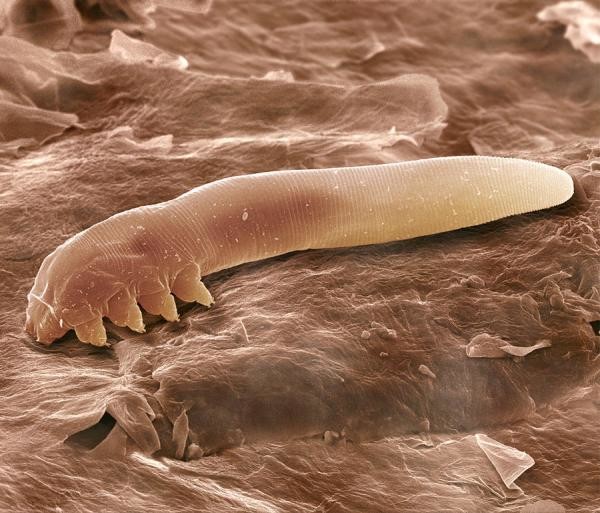 Подкожный клещ мал по своим размерам и увидеть его можно только под микроскопом
