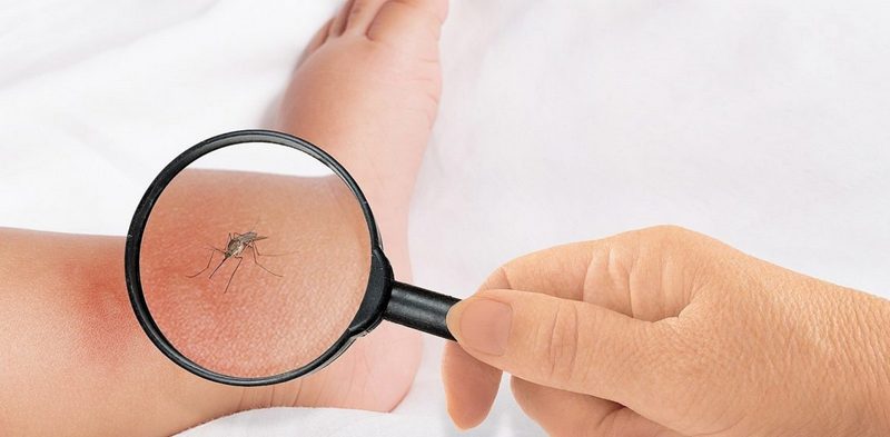 Чем мазать укусы комаров маленькому ребенку
